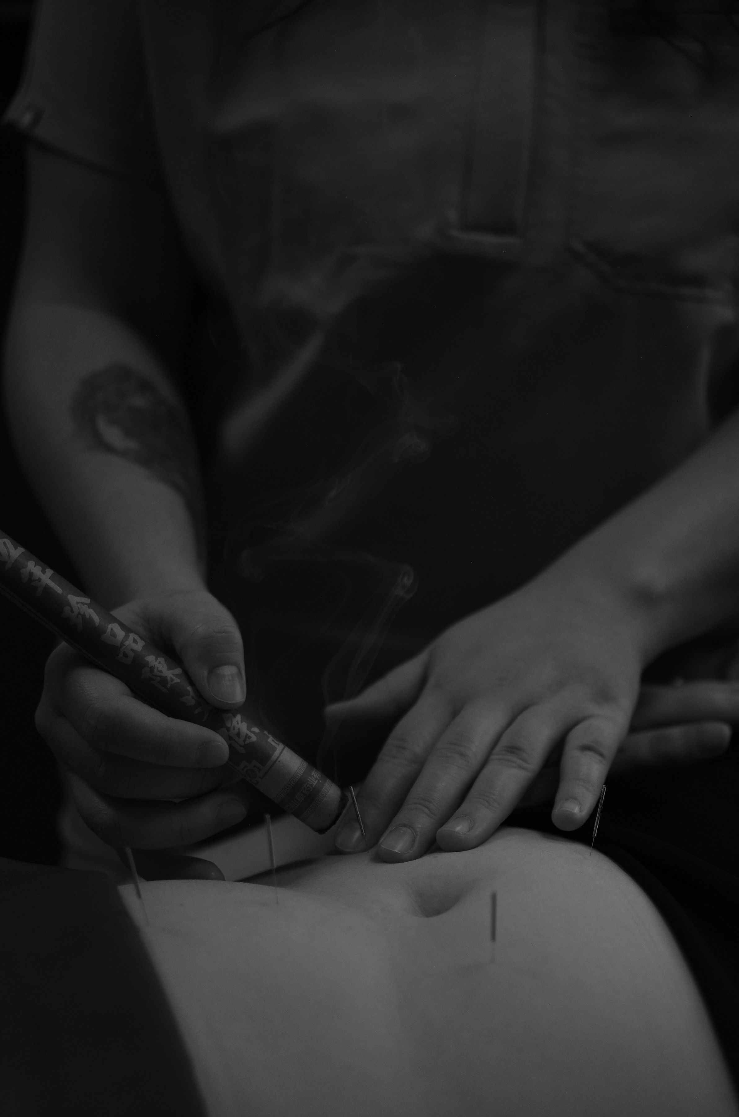 Moxibustion Sherwood Park